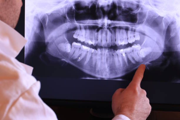 Best Pediatric Emergency Dentist in Fillmore, CA