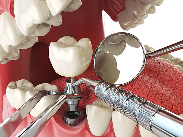 Best Emergency Dental Services for Seniors in Fillmore, CA